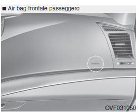 Air bag - sistema supplementare di sicurezza passiva